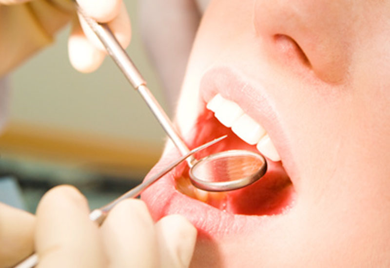 治療後の歯磨きと定期検診